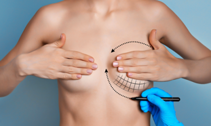 اعادة ترميم الثدي العملية التي تعيد البسمة والحياة لمريضات السرطان