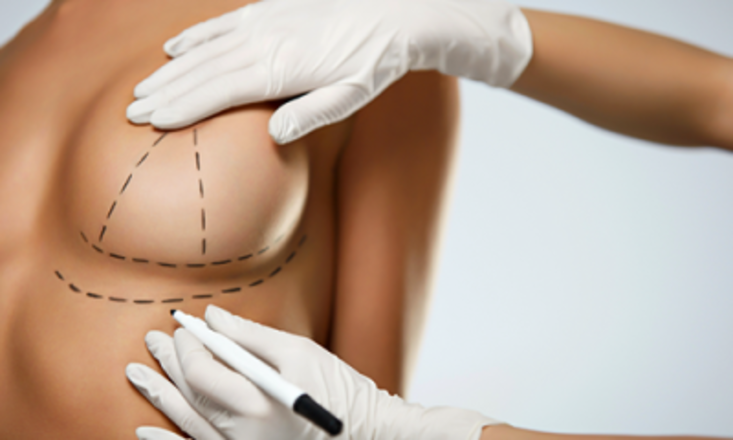 جراحات تجميل الثدي يقدمها الدكتور حلمي سليمان عمليات كثيرة ورعاية من القلب