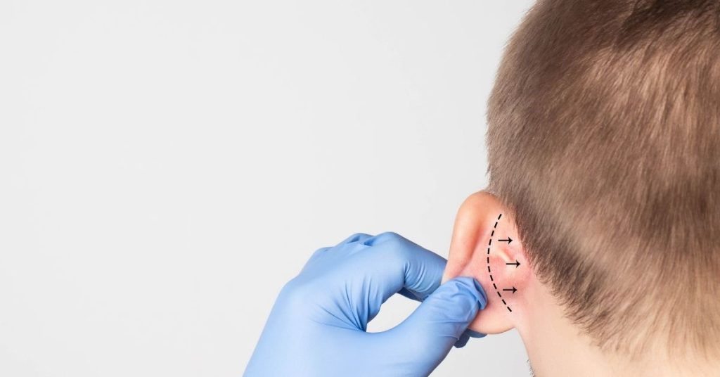 كم تكلف عملية تجميل الأذن وأفضل عيادة لإجراء الجراحة في مصر